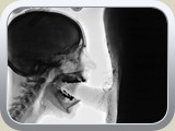x-ray mouthfull
